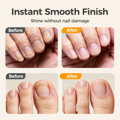 🔥Last Day Sale 50% OFF🔥2-in-1 Smart Electric Nail Trimmer u0026 Polisher for All Ages 👨‍👩‍👧‍👦 – Blade-Free, Blood-Free u0026 Stress-Free Nail Care! 💅